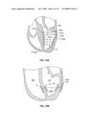 METHODS, SYSTEMS AND DEVICES FOR CARDIAC VALVE REPAIR diagram and image