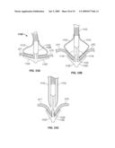 METHODS, SYSTEMS AND DEVICES FOR CARDIAC VALVE REPAIR diagram and image