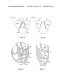 METHODS, SYSTEMS AND DEVICES FOR CARDIAC VALVE REPAIR diagram and image