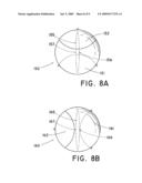 Flow-Deflecting Prosthesis for Treating Venous Disease diagram and image