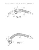 Devices and techniques for a posterior lateral disc space approach diagram and image