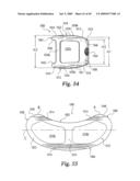 Devices and techniques for a posterior lateral disc space approach diagram and image