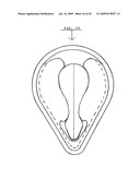 Shoelace holders diagram and image