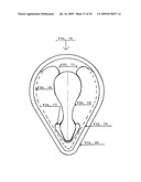 Shoelace holders diagram and image