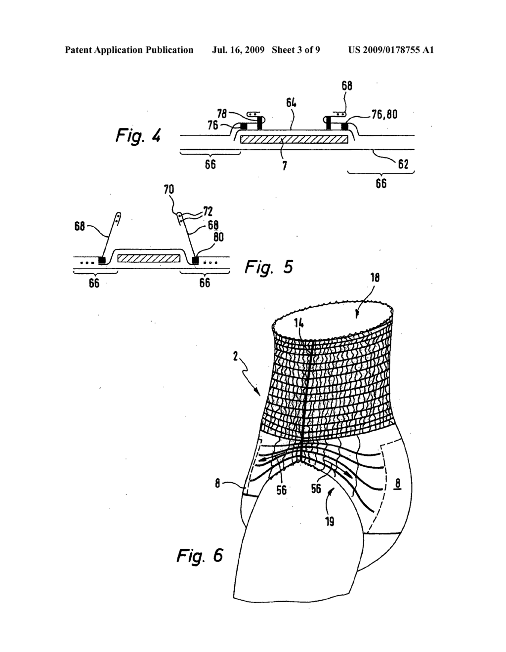 Method of producing incontinence articles in the form of pants - diagram, schematic, and image 04