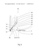 Extended Decompression Flap Arrangement diagram and image