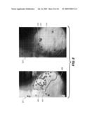 MICROCALCIFICATION DETECTION IN MAMMOGRAPHY CAD USING A CLASSIFIER diagram and image