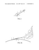 Self Adjusting Metal Stripper Fingers diagram and image