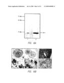 Id-1 and Id-2 Genes and Products as Therapeutic Targets for Treatment of Breast Cancer and Other Types of Carcinoma diagram and image