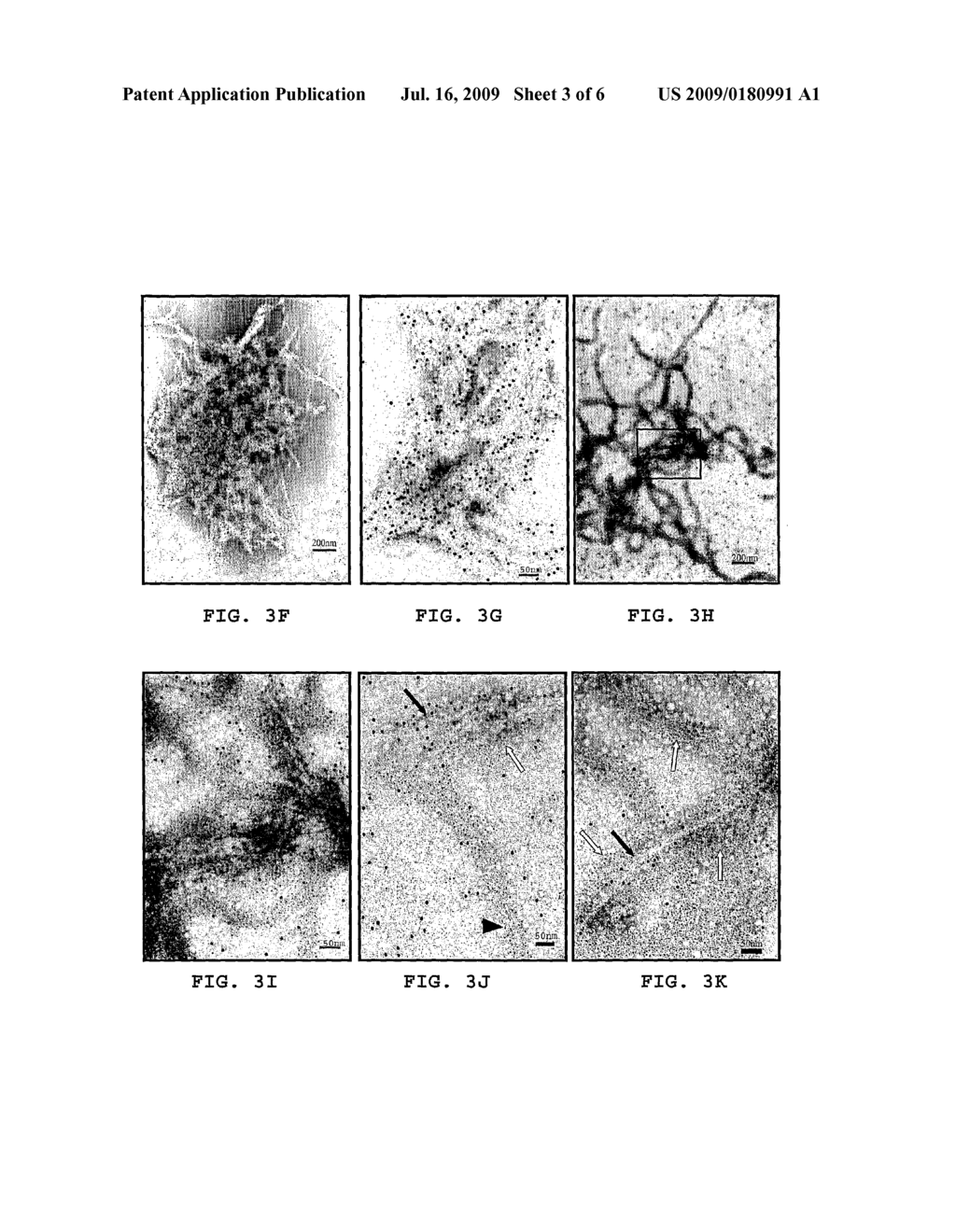 METHOD FOR TREATING INFLAMMATION ASSOCIATED WITH AMYLOID DEPOSITS AND BRAIN INFLAMMATION INVOLVING ACTIVATED MICROGLIA - diagram, schematic, and image 04