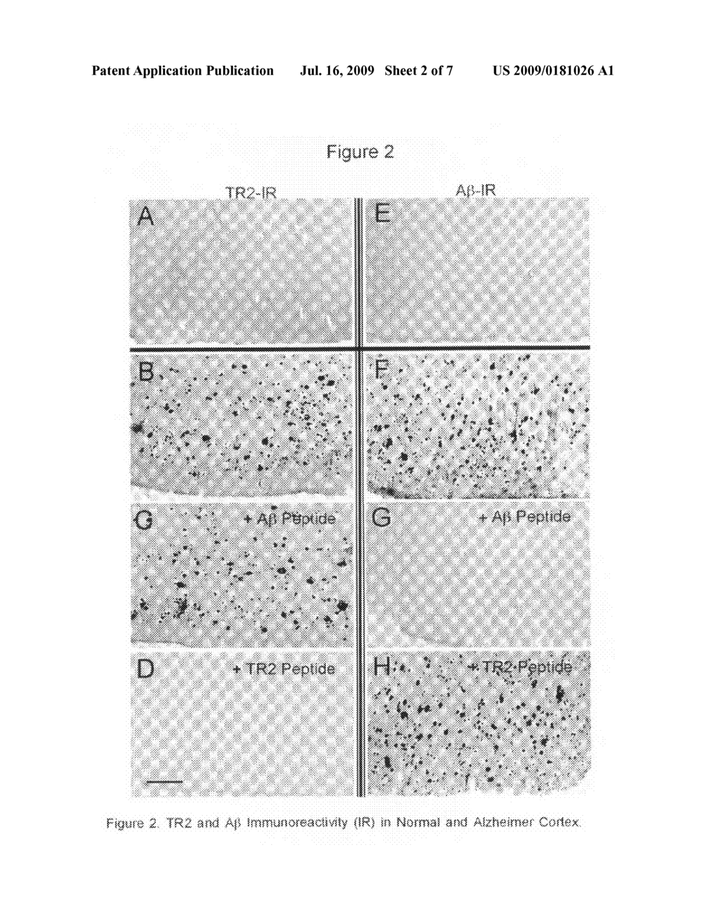 Tomoregulin-2-antibody compositions and methods for the diagnosis and treatment of Alzheimer's disease - diagram, schematic, and image 03