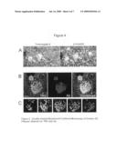 Tomoregulin-2-antibody compositions and methods for the diagnosis and treatment of Alzheimer s disease diagram and image
