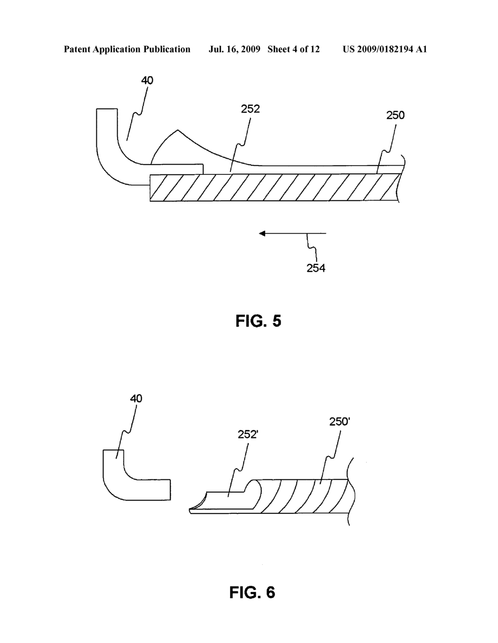 Positioning system for securing a treatment instrument at the end of a medical device - diagram, schematic, and image 05