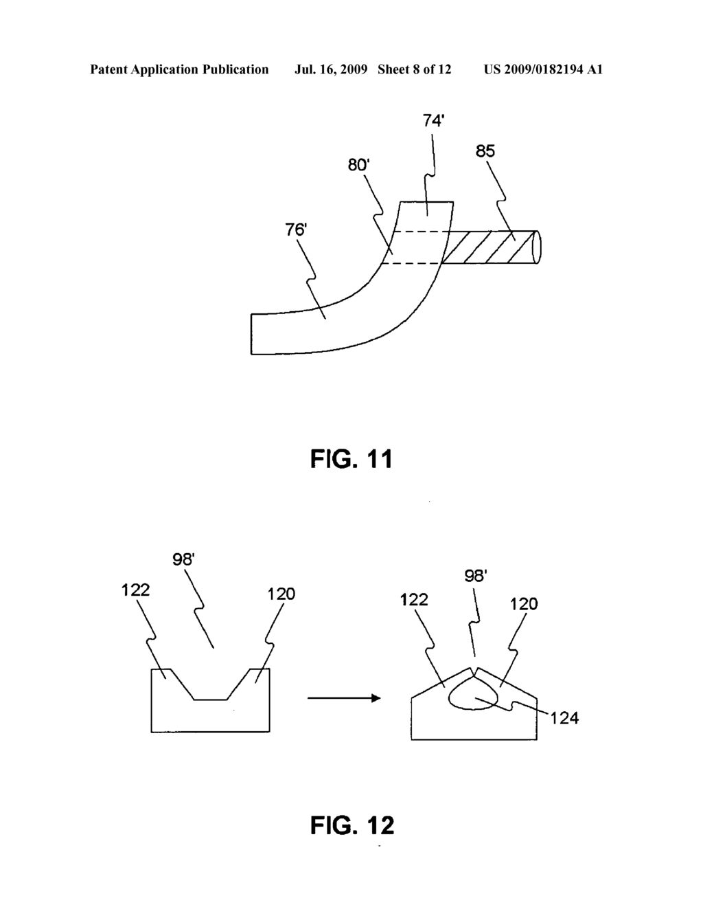 Positioning system for securing a treatment instrument at the end of a medical device - diagram, schematic, and image 09