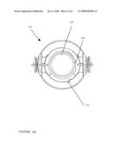 TROCAR STABILITY ASSEMBLY diagram and image