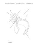 TROCAR STABILITY ASSEMBLY diagram and image