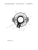 TROCAR STABILITY ASSEMBLY diagram and image