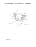 TROCAR STABILITY ASSEMBLY diagram and image