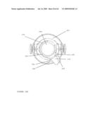 TROCAR STABILITY ASSEMBLY diagram and image