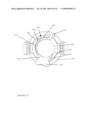 TROCAR STABILITY ASSEMBLY diagram and image