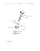 TROCAR STABILITY ASSEMBLY diagram and image