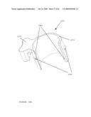 TROCAR STABILITY ASSEMBLY diagram and image