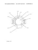 TROCAR STABILITY ASSEMBLY diagram and image