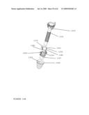 TROCAR STABILITY ASSEMBLY diagram and image