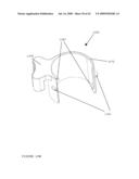 TROCAR STABILITY ASSEMBLY diagram and image