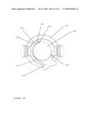 TROCAR STABILITY ASSEMBLY diagram and image