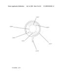 TROCAR STABILITY ASSEMBLY diagram and image