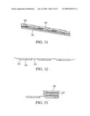 Tissue Distraction Device diagram and image