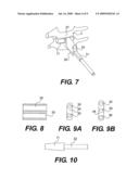 INSTRUMENT SET FOR FITTING AN INTERVERTEBRAL JONT PROSTHESIS diagram and image