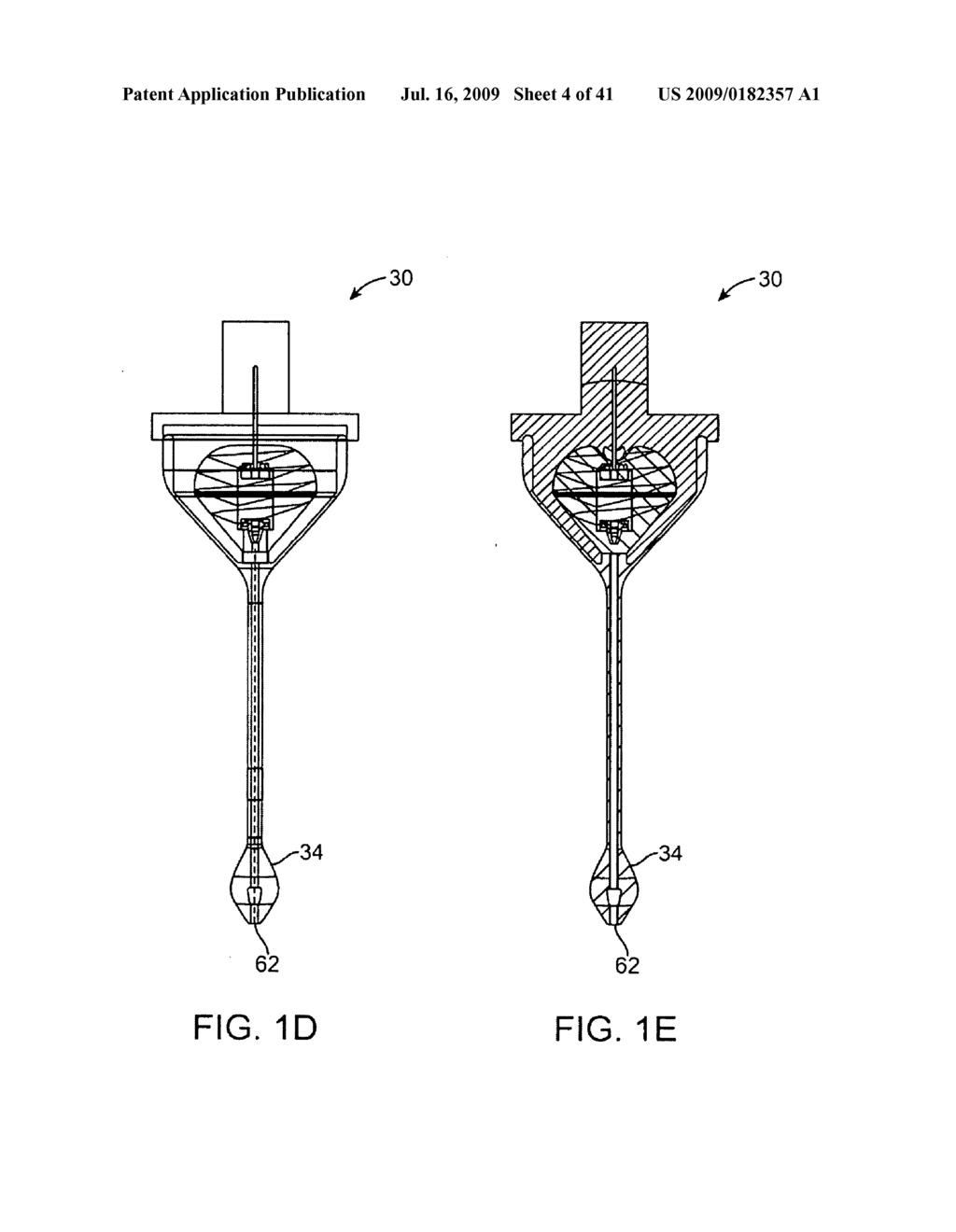 DEVICE FOR INTERMITTENTLY OBSTRUCTING A GASTRIC OPENING AND METHOD OF USE - diagram, schematic, and image 05