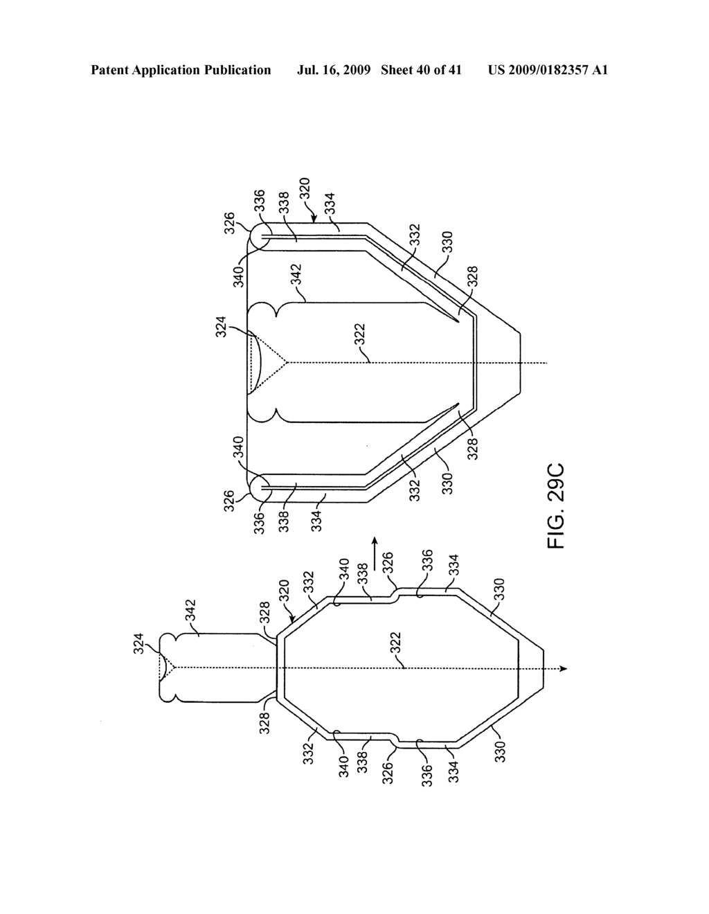 DEVICE FOR INTERMITTENTLY OBSTRUCTING A GASTRIC OPENING AND METHOD OF USE - diagram, schematic, and image 41