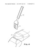 IMPLANT DEVICE USED IN MINIMALLY INVASIVE FACET JOINT HEMI-ARTHROPLASTY diagram and image