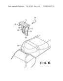 IMPLANT DEVICE USED IN MINIMALLY INVASIVE FACET JOINT HEMI-ARTHROPLASTY diagram and image