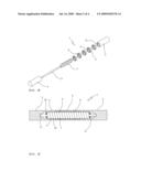 FLEXIBLE ROD FOR FIXING VERTEBRAE diagram and image