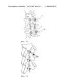 FLEXIBLE ROD FOR FIXING VERTEBRAE diagram and image