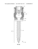 SPRING-LOADED DYNAMIC PEDICLE SCREW ASSEMBLY diagram and image