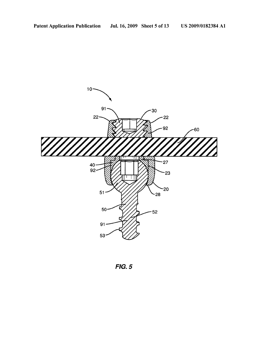 MATERIAL COMBINATIONS FOR MEDICAL DEVICE IMPLANTS - diagram, schematic, and image 06