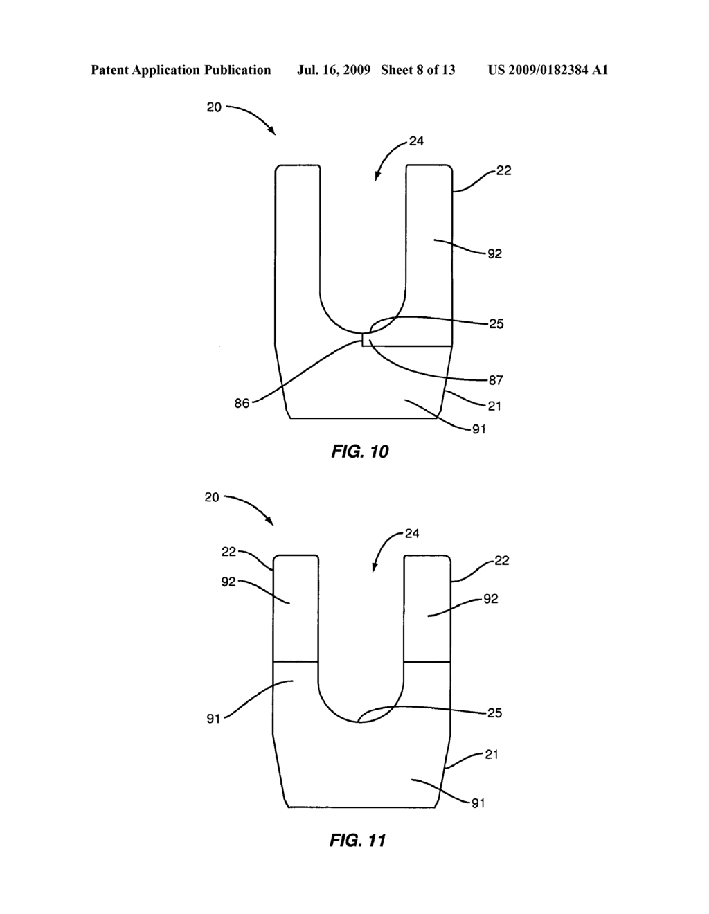 MATERIAL COMBINATIONS FOR MEDICAL DEVICE IMPLANTS - diagram, schematic, and image 09