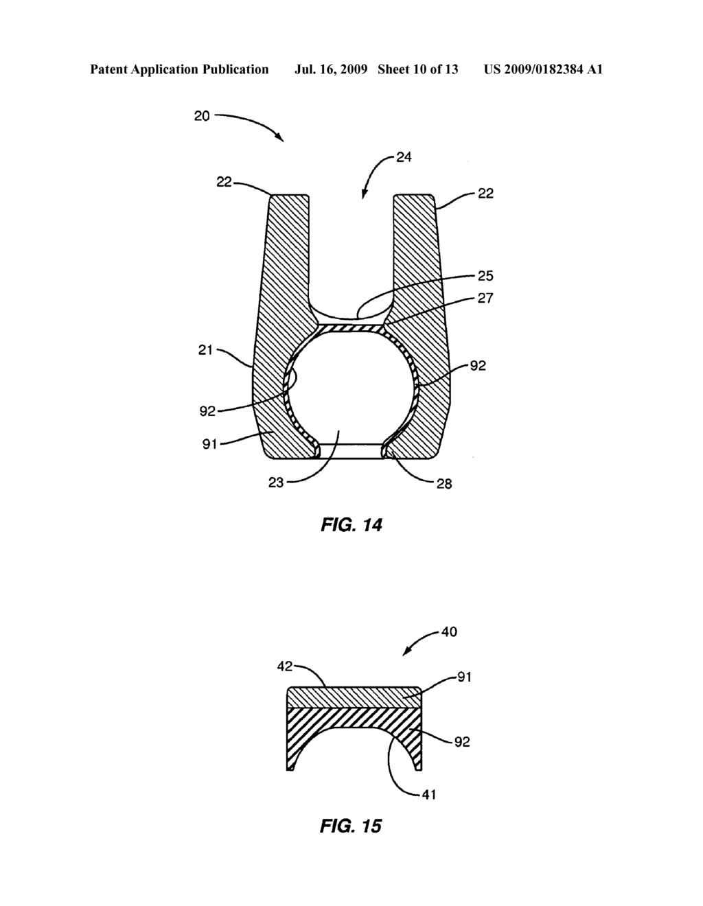 MATERIAL COMBINATIONS FOR MEDICAL DEVICE IMPLANTS - diagram, schematic, and image 11