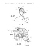 APPARATUS AND METHODS FOR APPLYING NEURAL STIMULATION TO A PATIENT diagram and image