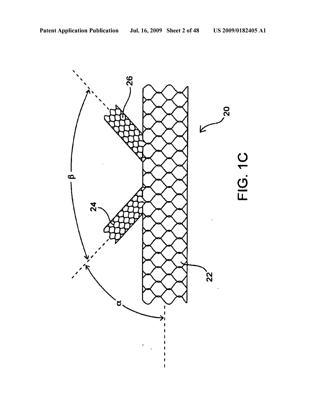 APPARATUS AND METHOD FOR DEPLOYING AN IMPLANTABLE DEVICE WITHIN THE BODY - diagram, schematic, and image 03