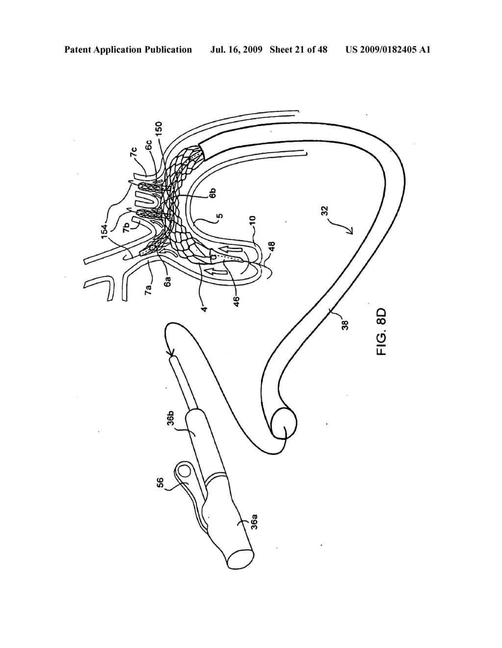 APPARATUS AND METHOD FOR DEPLOYING AN IMPLANTABLE DEVICE WITHIN THE BODY - diagram, schematic, and image 22