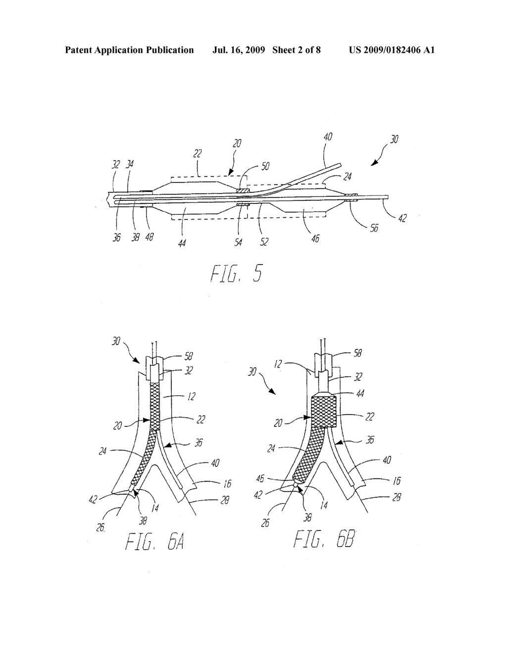 BIFURCATED STENT DELIVERY SYSTEM - diagram, schematic, and image 03