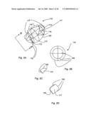 Bioerodible self-deployable intragastric implants diagram and image