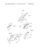 Bioerodible self-deployable intragastric implants diagram and image