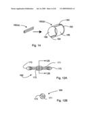 Bioerodible self-deployable intragastric implants diagram and image